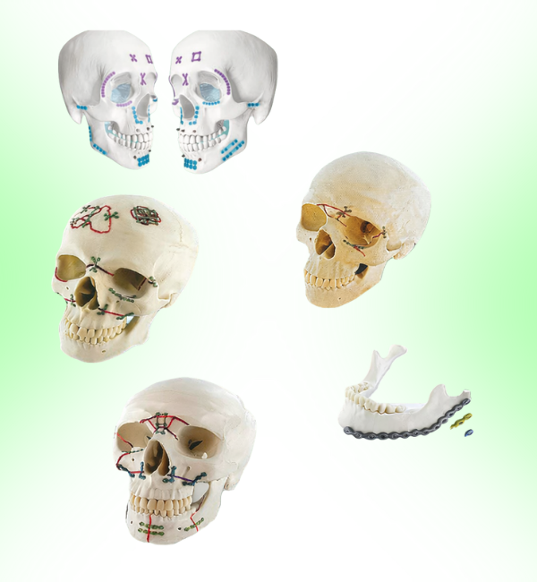 Maxillofacial Implant System